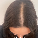 Hair Growth Tonic